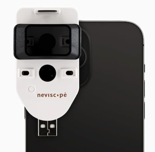 TriSeven Neviscope - Dermatoscopio telefonico con obiettivo/luce LED, 100 x fotocamera con clip universale per la maggior parte dei telefoni iPhone/Android per bambini e adulti