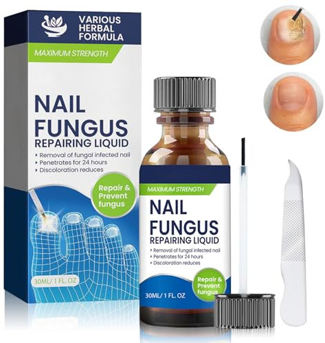 Mutree Traitement Mycose Ongles Des Pieds, Traitement Ongles Solution Pour Les Ongles Décolorés,Épaissis,Émiettés,Soin Professionnel Pied Pour le soin des Ongles, 30 ml