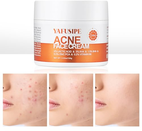 YAFUSIPE Acne Treatment for Face for Hormonal Cystic Stubborn Acne Cream for Sensitive Skin Teens Adults Women Men Spot Pimple Butt Control Rapid Clearing Breakout Overnight Face Blemish Treatment