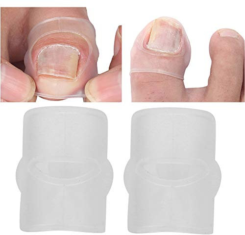 2 Pezzi Strumento per la Correzione Dell'unghia del Piede Incarnita in Silicone, Morsetto a Strisce Correttore Trattamento per Alleviare il Dolore Correttore Trattamento