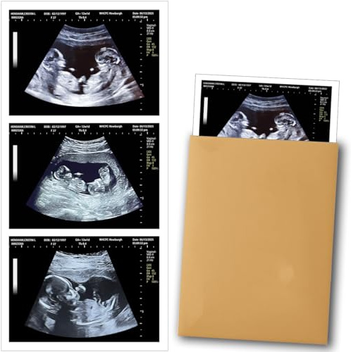 Generisch Personalised Fake Ultrasound Image - Funny Pregnancy Picture to Customize, Joke Item for Couples, Partner or Spouse