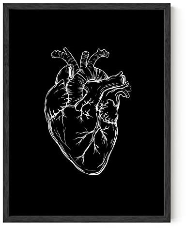 HAUS AND HUES Schwarz-weiße Wanddekoration, Herz-Wandkunst, dunkle Akademie, Raumdekoration, Gothic-Wandkunst, Herz-Anatomie-Poster, Anatomie-Kunstbild, Wanddekoration, Herzkunst (schwarzer Rahmen,