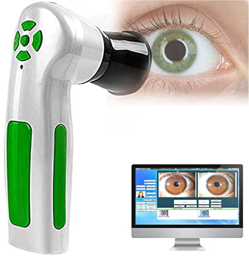 Iris-Analysekamera, tragbarer Iris-Detektor mit USB2.0-Schnittstelle, 12-Millionen-Pixel-Iris-Detektor, Autofokus-Iris-Maschine, Win7, Win8, Win10, Win11, linker und rechter Beleuchtungsschalter