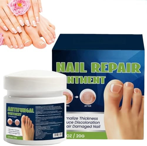 Fungel Nail Treatmet Cream,Fungel Nail Treatmet for Toenails Extra Strong,Nail Repair Fungal Nail Cream,Ingrown Toenail Treatment,Nail Growth Treatment,Nail Hardener,Nail Strengthener,Nail Growth