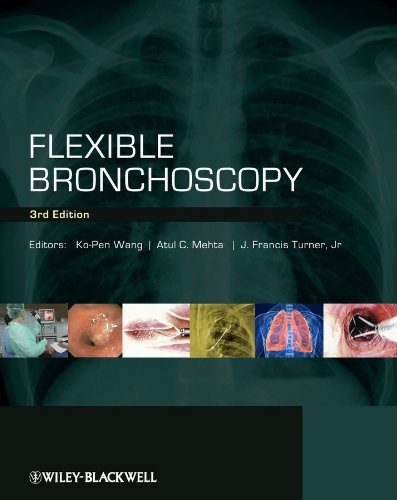 Flexible Bronchoscopy (English Edition)