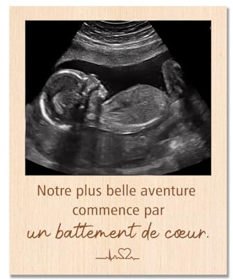 Capaneus Annonce Grossesse Cadre Photo, Cadre Photo Echographie, Notre plus belle aventure commence par un battement de cœur, Cadeau Grossesse pour Nouvelle Maman