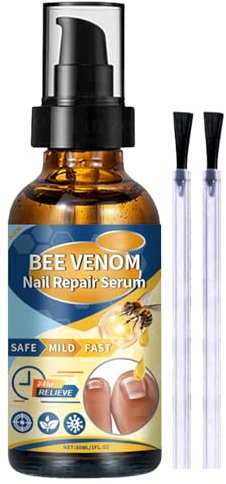 Behandlung von Fußnägeln, Behandlung von Pilzen und Mykosen, Nail Repair ätherisches Öl, Nagelpflege, verbessert die Gesundheit der Finger- und Fußnägel, 30 ml