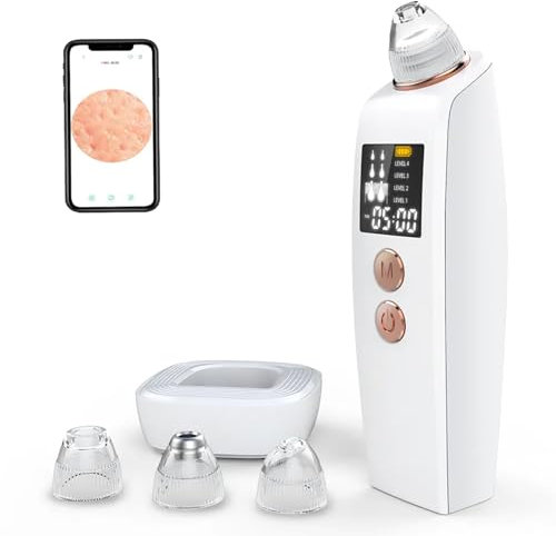 TsoLay Outil D'extraction De Points Noirs, Instrument De Points Noirs avec Caméra HD 30 W, Aspirateur De Pores pour Enlever Les Points Noirs, Se Connecte avec Un Smartphone/4 Puissances D'aspiration