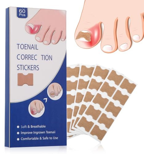 60 Stück eingewachsene Zehennägel-Behandlungsflicken, atmungsaktive Zehentrenner, schmerzloser Hammerzehenkorrektor, langlebige Zehen-Abstandshalter, schnelle Reparatur eingewachsener Nagelwerkzeug