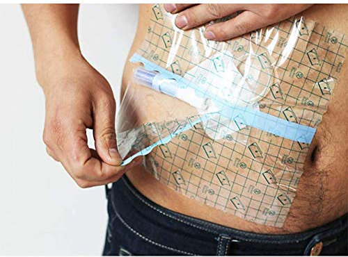 XJZHANG Feuchtigkeitsbarriere für Wundauflagen, Duschschild mit Leitungsabdeckung, wasserdichte Katheterschutzabdeckung, Duschschild mit Peritonealdialyse