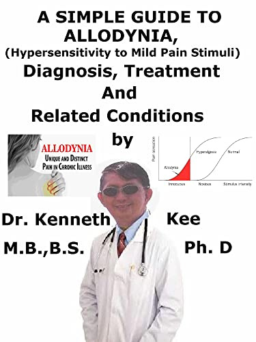 A Simple Guide To Allodynia, (Hypersensitivity to Mild Pain Stimuli) Diagnosis, Treatment And Related Conditions