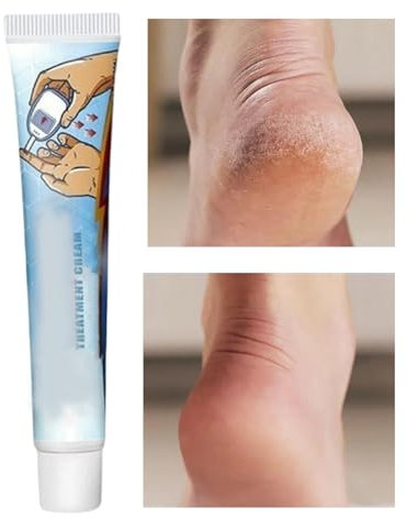 Fußcreme Für Frauen | Feuchtigkeitsspendende Fußpflege,Nicht Fettende Kühlende Natürliche Reparatur Salbe Gegen Juckreiz Für Frauen Männer Ältere Menschen Mit Feuchtigkeitspflege 20g