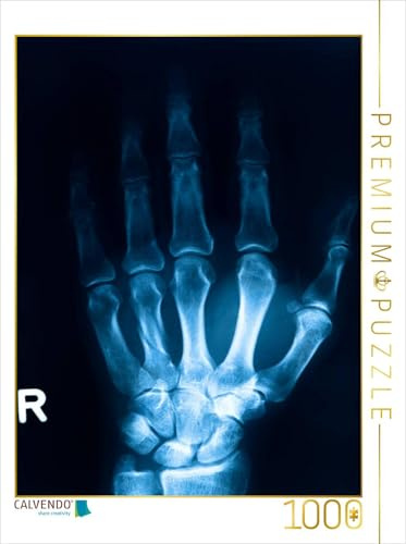 CALVENDO Puzzle Röntgenbild von einem Handknochen. | 1000 Teile Lege-Größe 48 x 64 cm Foto-Puzzle für glückliche Stunden