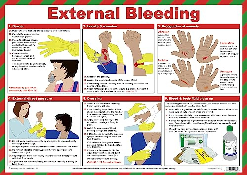 Safety First Aid External Bleeding Poster, A2 | 60cm x 43cm, Laminated