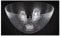Salad Bowl Set of 2 Re-usable Plastic Dimple Design Perfect for BBQs & Picnics