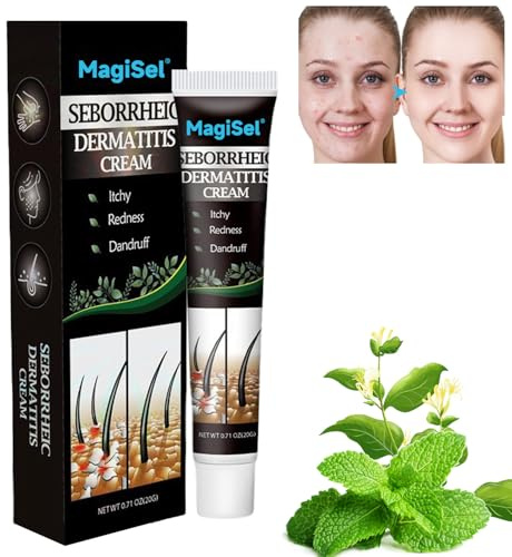 Crema para el cuidado del cuero cabelludo, Crema paras Dermatitis seborreica Cremas, Cremas paras el picor de la piel, Aliviar la picazón seca 20G