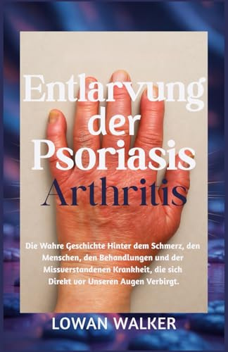 Entlarvung der Psoriasis-Arthritis: Die wahre Geschichte hinter dem Schmerz, den Menschen, den Behandlungen und der missverstandenen Krankheit, die sich direkt vor unseren Augen verbirgt.