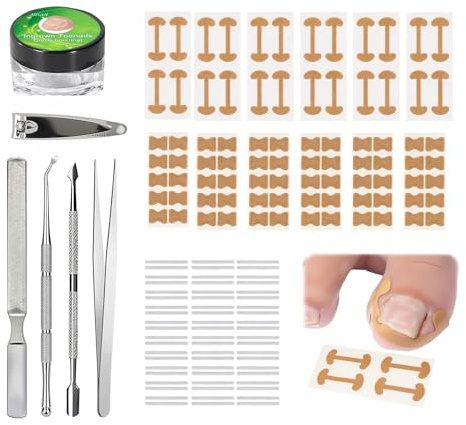 Ruvan Ongle Incarné Kit, Kit Ongles Incarnésen Forme De C, Correcteur De Paronychie, Autocollant De Correction Des Ongles, Kit De Soin Des Pieds En Acier Inoxydable Professionnel Pour Paronychie