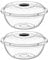Best House | Clear Round Basin Bowl with Lids | 7.5 Litres | 2 Pcs | Transparent | Salad Bowls | Plastic Food Storage Container With Lids (Pack of 2)