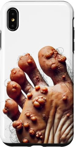 iPhone XS Max Funny Ugly Cringe Phone Case