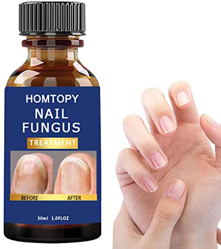 Durcisseur et fortifiant pour Ongles | Mycoses Solution Extra Forte pour Les Ongles,Nail Repair Fast Strong Nails pour restaurer l'apparence des Ongles décolorés ou endommagés