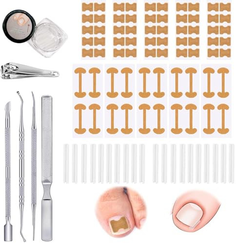 105 Stück ongle incarné orteil ongles incarnés pieds outil pour ongles incarnés ongles incarnés pieds correcteur ongle orteils correcteur manucure ongle incarné kit ongle incarne pieds