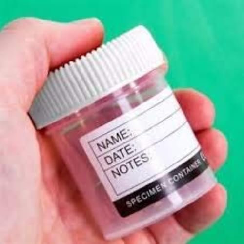 Sterilin Urine Collection Sample Bottles Specimen Storage Pot Graduated Plastic Container with Lid for Urine Medical Collection Volume-60ml - Pack of 10