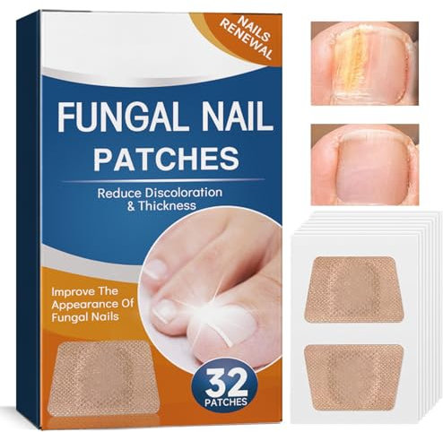 DMQ Fungal Nail Treatment for Toenails Extra Strong, 32Pcs Nail Repair Patches, Toenail Nail Fungus Treatment Pads, Antifungal Nail Treatment - Ingrown Nail Relief & Damaged Nail Recovery