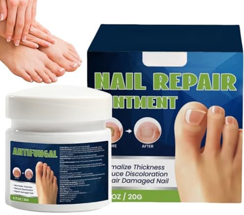 Nail Treatment Cream,Toenail Treatment Cream,Toenail Crea-m,Nail Treatme-nt for Toenails Extra Strong,Nails Polish Crea-m,Nails Repair Herbal Essence,Ingrown Toenails Treatm-ent,Cuticle Crea-m