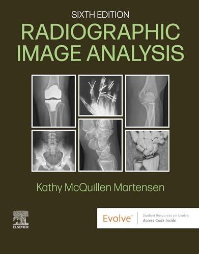 Radiographic Image Analysis - E-Book (English Edition)