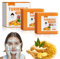 2 PCS Kurkuma Seife für Gesicht, Turmeric Kojic Acid Soap, Turmeric Soap, Kojisäure-Seife für Hyperpigmentierung, Entfernen Dunkler Flecken, Aufhellend Feuchtigkeitsspendend Gleicht Den Hautton