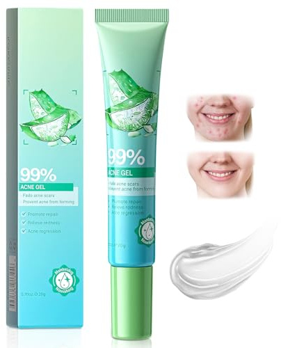 25g Anti-Boutons Gel,Gel Nettoyant Anti-Boutons,Crème Anti Acné,pour Réduit les BoutonsImperfections Localisées,Convient Aussi Bien Aux Hommes Qu'aux Femmes