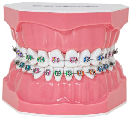 Dentalmall Dental Teeth Orthodontic Demonstration Model Typodont Teaching,Studying,Explaining Model for Adult and Children