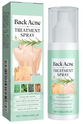 Back Acne Treatment, Tea Tree Oil Body Acne Spray, Gentle Acne Oil For Back, Body, Chest, Fast-Acting Acne Treatment for Spots & Marks, Hydrating Body Spray, All Skin Types