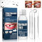Kit de Reparación de Dientes, Perla Dental Incluye Kit de Restauración Dental, Perla Dental para Dientes Rotos Faltantes Material de Relleno de Dientes Dentales, 30g