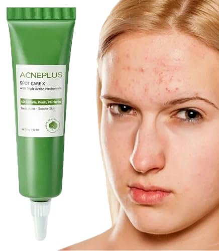 DMQ Anti Acne Face Cream,Gentle Acne Cream for Acne Prone Skin,Anti Acne Removal Cream with Plant Extract,Moisturiser Face Cream for Acne Mark,Fade Acne Mark & Calm Acne Redness,Scar Removal Cream
