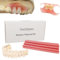 Kit de matériel de prothèse pour réparer les dents manquantes ou les fausses dents de dentier complet