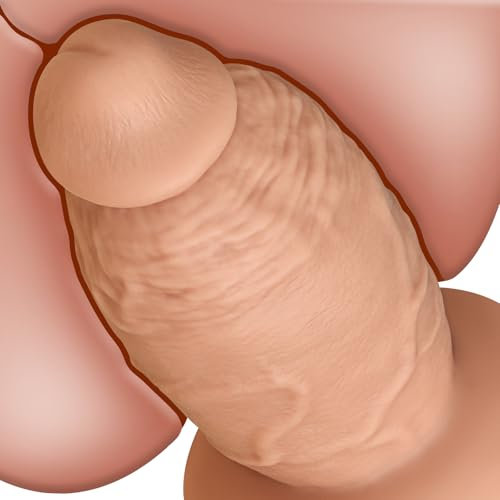 19 * 9.5 cm Spessore Fallo XXL Dildo Anale Senza Testicoli, Mostro Gigante con Forte Ventosa per Mani Libere e Gioco Anale, Grande Pene in Silicone Giocattolo Sessuale per Donne Uomini Coppie Gay