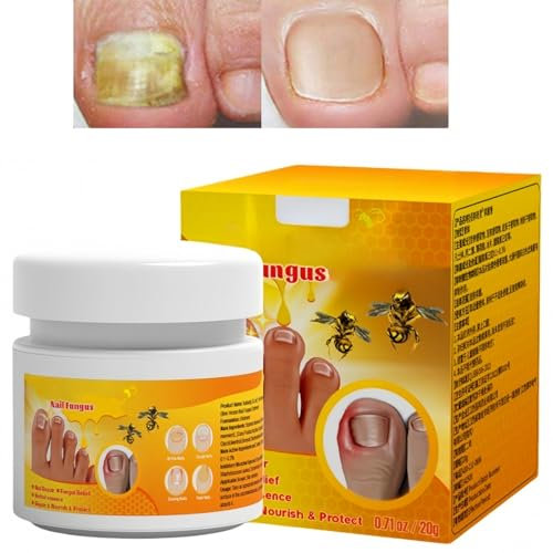 Fungal Nail Treatment Cream,Bee Ven/om Fungal Nail Treatment,Antifungal Nail Polish Cream,Fungal Nail Treatment for Toenails Extra Strong,Fungal Toenail Treatment Cre/am,Anti Fun/gal Nail Tre/atment
