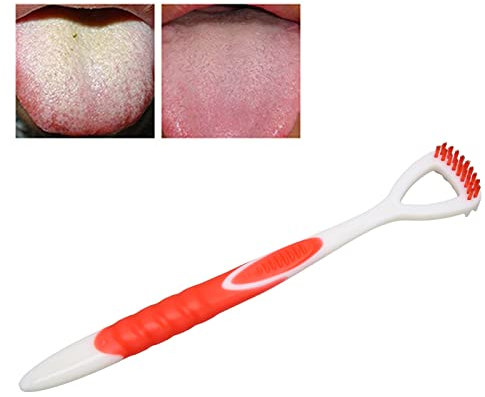 Brosse À Langue, Grattoir À Langue, Élimination De La Mauvaise Haleine, Brosse À Langue, Outil De Nettoyage Pour Soins Bucco-Dentaires, Nettoyeur De Langue Pour Adultes Et Enfants(Rouge)