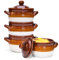 Vumdua Französische Zwiebelsuppenschalen mit Deckel und Griffen, 473 ml, Keramik, Suppentöpfe für Chili, Müsli, Müsli, Topfkuchen, Ofen, Braten und Spülmaschine, 4 Stück