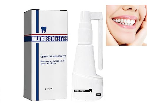 TBeautfave Dental Calculus Cleaning Spray, Long Lasting Refreshing Tartar Remover for Teeth - Plaque Remover for Teeth Teeth Whitening Spray Halitosis Treatment (30ml)