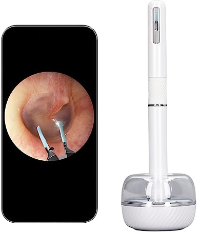Ohrenschmalz-Entfernungswerkzeug, Ohrenreiniger mit Kamera und LED-Licht, Sichtbares Ohrkamera-Otoskop, 10 MP 360-Grad-Weitwinkel-Ohrenschmalz-Entferner-Picker (Weiss)