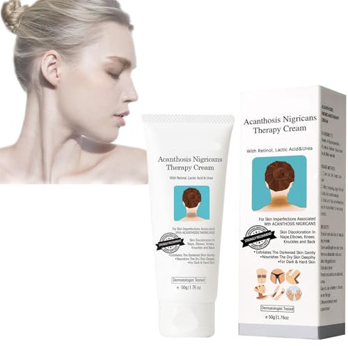 Mikabila (04) Crema Contro le Macchie Scure, 50g Crema Acanthosis Nigricans, Crema Terapeutica Acanthosis Nigricans, Crema Sbiancante per le Ascelle, Rimozione Dell'iperpigmentazione