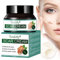 Narbencreme, Narbensalbe, Dehnungsstreifen Creme, Narbencreme Gesicht, Scar Cream, Akne Creme, Akne-Flecken, C-Schnitte, Brennen, Akne, Alte & Neue Narben, Dehnungsstreifen