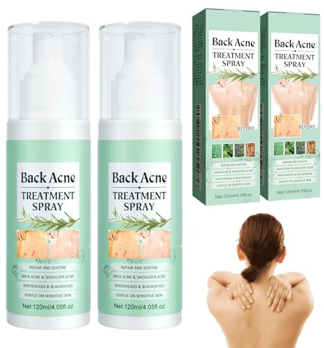 Akne Rücken Spray, 2 Stück Rücken Back Acne Spray, Gegen Pickel Rücken, Rücken-Peeling Tiefenreinigung, Akne-Behandlungsspray für Körper, Brust und Rücken, Sanft zur Haut