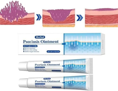 KoTinea Soothing Ointment, KoTinea Psoriasis Cream, Psoriasis Ointment Extra Strength, Psoriasis Treatment, for All Skin (2Pcs)