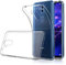 Simpeak Schutzhülle für Huawei Mate 20 Lite, transparent, kompatibel mit Huawei Mate 20 Lite, kompatibel mit Huawei Mate 20 Lite, Silikon-TPU-Hülle