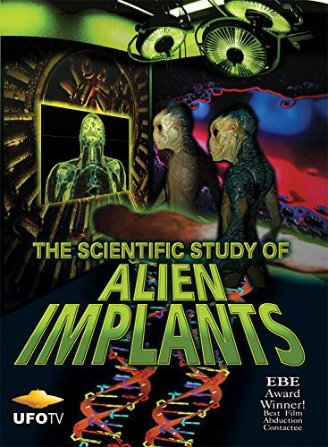 SCIENTIFIC STUDY OF ALIEN IMPLANTS.