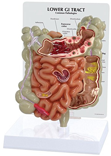 GPI Anatomicals 3342 Magen-Darm Trakt Modell, 1019556
